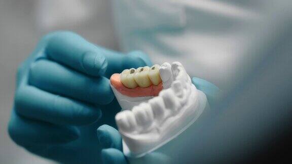 一名戴着手套的牙科技师手里拿着牙齿的石膏模型
