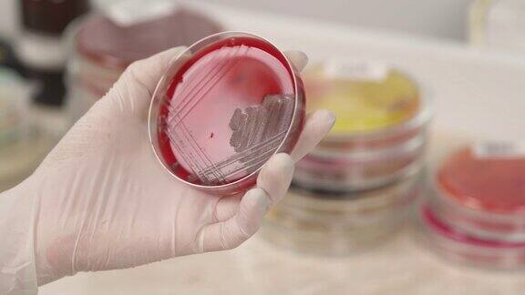 在微生物实验室医护人员手拿培养皿的特写医学研究