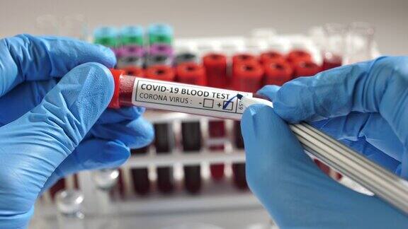 冠状病毒血液检测呈阳性装有冠状病毒阳性血液的试管放在实验室桌子上医学