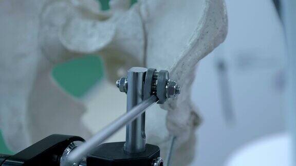 骨盆骨折、股骨颈骨折修复的高科技建议