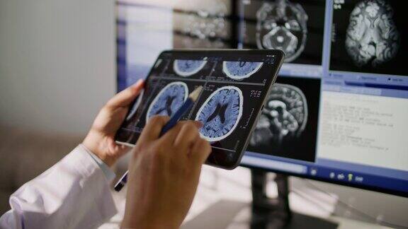 医生在平板电脑上看CT检查图像