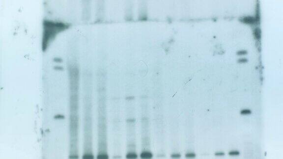 Covid-19大流行病毒DNA遗传分析结果