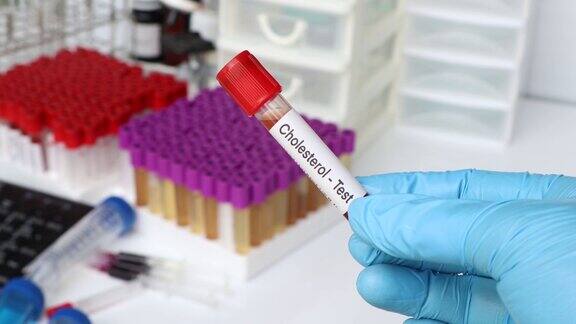 胆固醇测试从血液中寻找异常