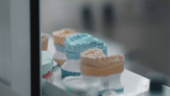 牙科实验室的牙齿石膏模型