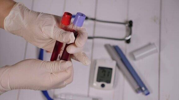 一个戴着手套的医生拿着两瓶血的特写一个糖尿病的测试
