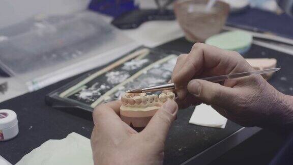 一位牙医在实验室里制作了一个下颌义齿和陶瓷牙的模型用刷子在种植体上涂油漆人工牙齿新技术在牙科中的应用