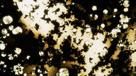 通过显微镜背景看到的白色受损细胞
