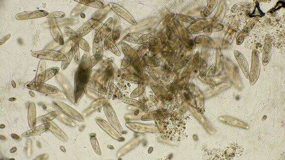 大菌落InfusoriumParamécium在显微镜下
