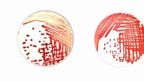 细菌在培养皿中营养培养基上菌落的俯视图特写镜头微生物科学实验室的微生物培养实验