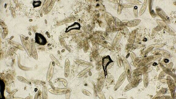 大菌落InfusoriumParamécium在显微镜下