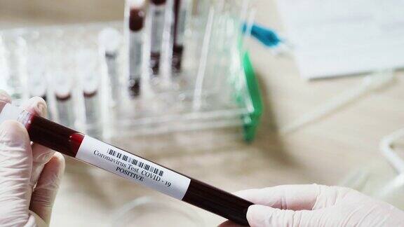 COVID-19实验室检测阳性试管血液