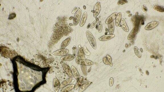 菌落纤毛Paraméciumcaudátum显微镜下时间推移