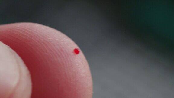 手指刺戳测量血糖极端宏观血液试纸