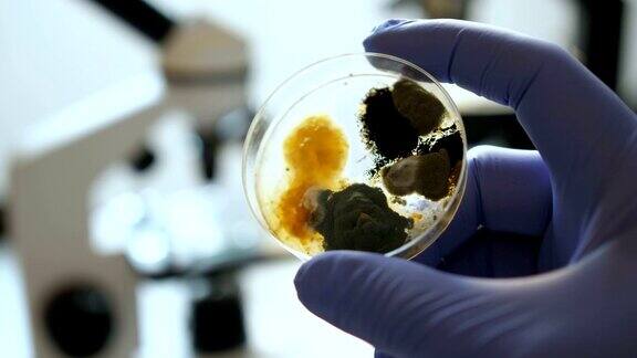 科学家在细菌培养中进行分析特写镜头化学实验室细菌培养皿手拿蓝色手套的培养皿与霉菌和细菌菌落科学专业嫁接细菌