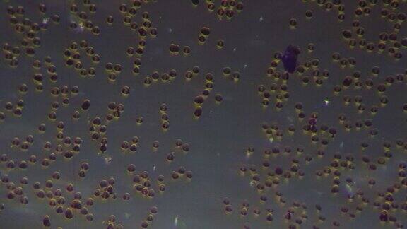 人血涂片在400倍显微镜下斜照拍摄