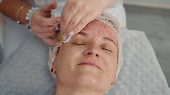 医生向一位女病人的脸上注射血浆用注射富血小板血浆的方法治疗在美容院治疗