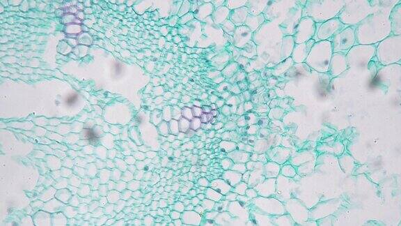 在200倍放大显微镜下看到的植物的横切面上的幼根
