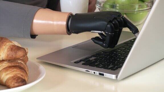 在笔记本电脑上用仿生手腕打字的不可辨认的截肢者