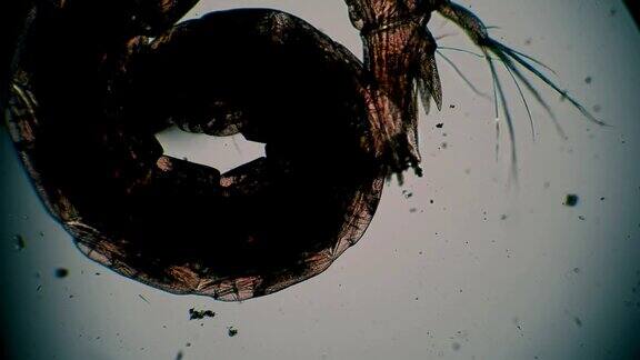 摇蚊幼虫在显微镜下移动