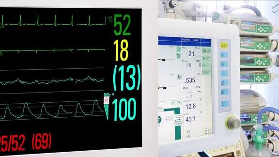 重症监护室的医疗设备心脏和生命体征监测