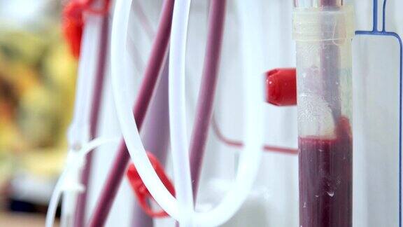 血液透析在人体上的设备