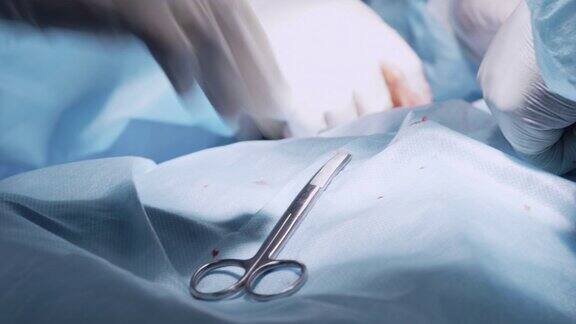 外科医生戴着带血的手套做手术的手
