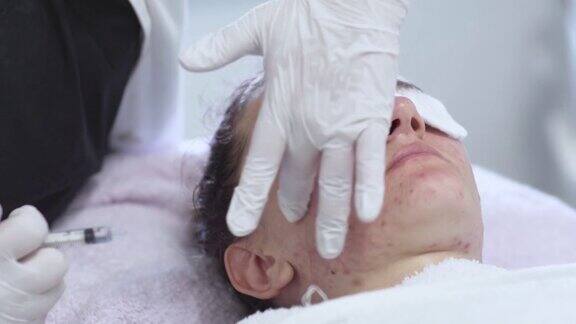 美容师将医用美容凝胶从注射器中涂在一个年轻女子有问题的脸上美容师做面部皮肤护理治疗