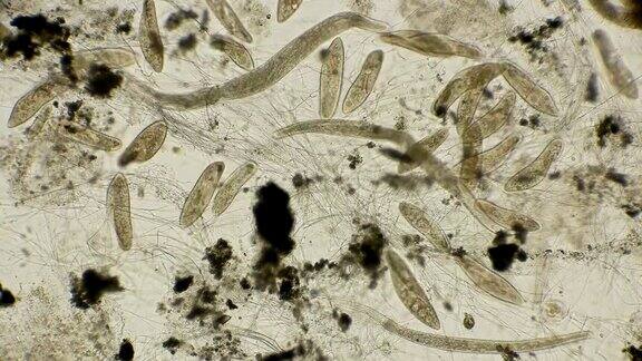 菌落纤毛Paraméciumcaudátum和螺旋体在显微镜下