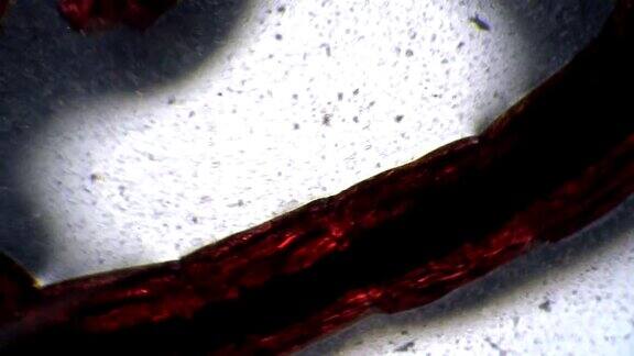 这种蚊子的红色幼虫在显微镜下是半透明的