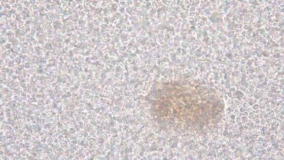 显微镜下的芽殖酵母细胞