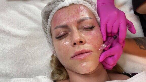 抗衰老程序:专业美容师在中西医结合的过程中对女性面部皮肤进行多次注射生物活肤拉皮