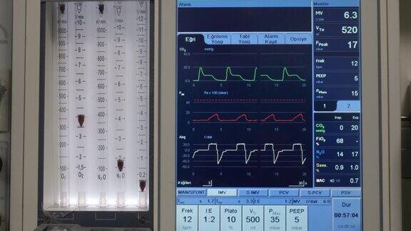 4K麻醉机呼吸机监视器在手术室里挽救病人生命的医疗设备特写镜头医疗设备重症监护病房麻醉机呼吸机工作存量视频