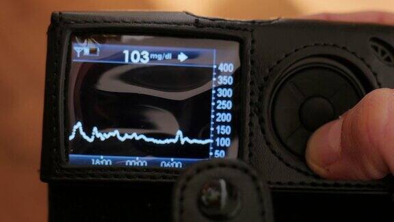 在dexcom接收器上检测血糖水平实时血糖读数