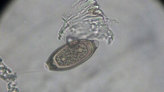 光显微镜下鞭虫卵