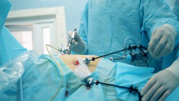 医生在腹腔镜手术中拆除手术棒