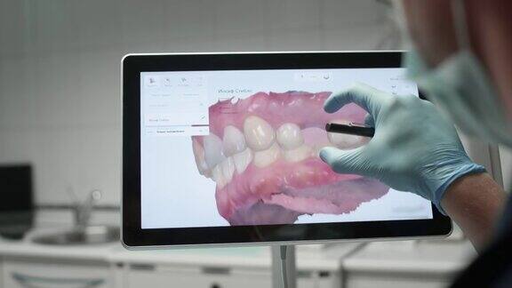 医生检查颌骨的三维模型一名牙医正在检查监视器上的牙齿数字图像现代医学和牙科技术