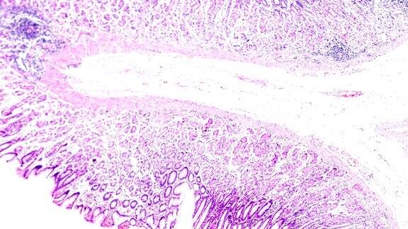 镜下胃黏膜肠化