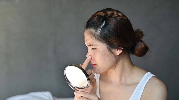 忧虑的亚洲妇女与坏情绪而看着痤疮和疤痕出现在她的脸上的迷你镜子