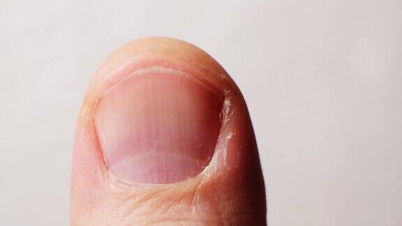 一个蓬头垢面的男人指甲的特写镜头指甲保健概念