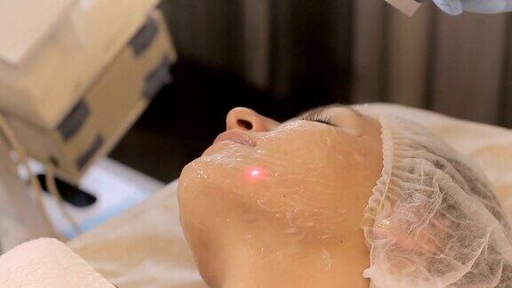 美容师用医用激光在女性的脸上做手术