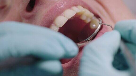 牙科医生检查病人牙齿