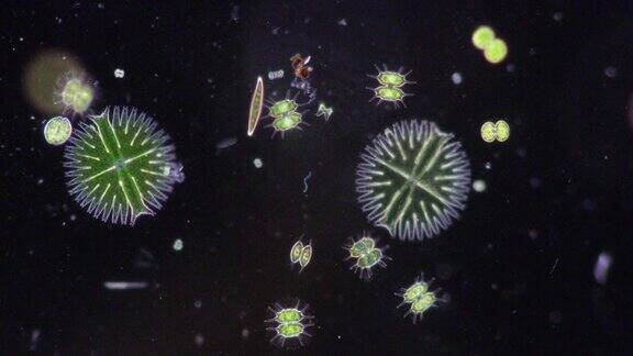 显微镜下废水中的原生动物和绿藻