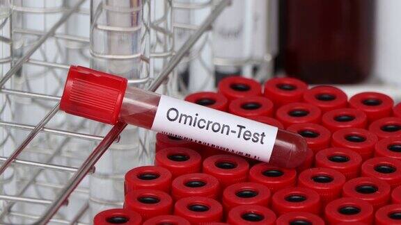 从血液中寻找异常的欧米克隆测试
