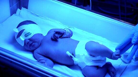 保育箱里的早产儿刚出生的可爱的婴儿与手夹在脐带在医院托儿所高清