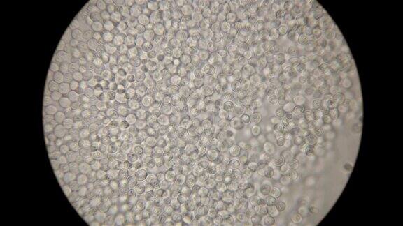 酵母在显微镜下移动
