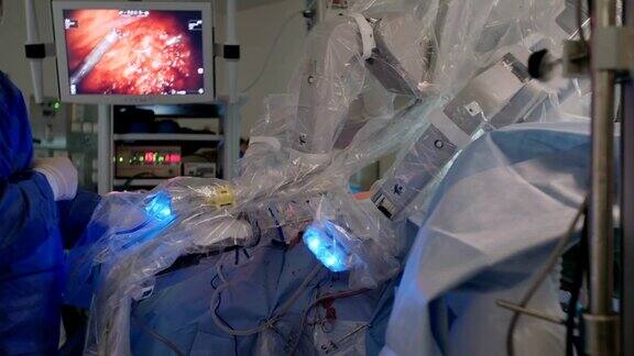 达芬奇手术系统的微创机器人手术