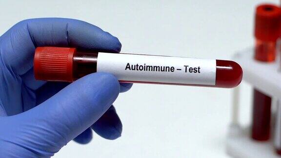 自体免疫检查医生拿着血样放在试管里健康检查