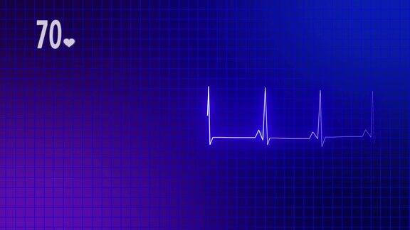心电图心脏监视器