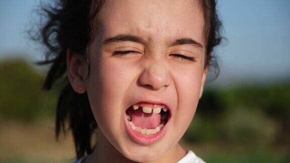 小女孩的牙齿问题很严重