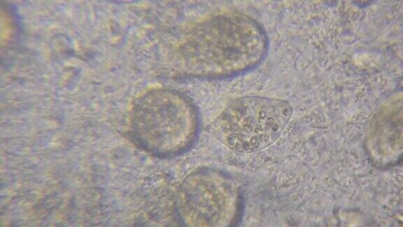 水中原生动物微生物的显微镜图像片段显示纤毛虫草履虫细菌螺旋体和藻类